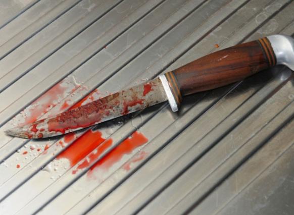 Порезал лицо и шею: в Ростовской области пьяный мужчина с ножом напал на улице на девушку